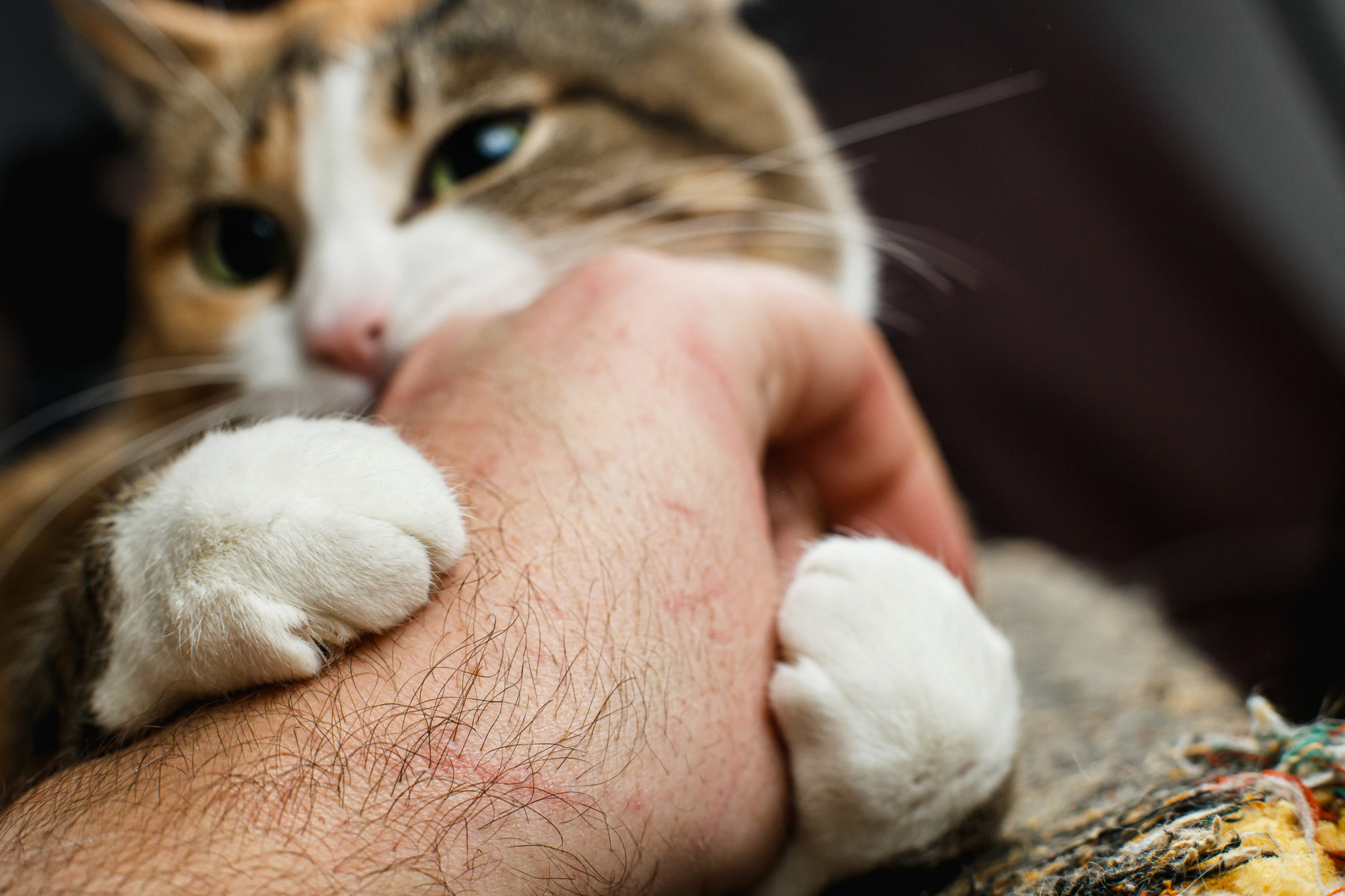 Understanding the Effects of Cat Scratch Disease in Amesbury, MA